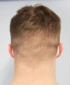 the back of a shaved head