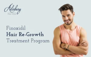 finoxidil hair treatment