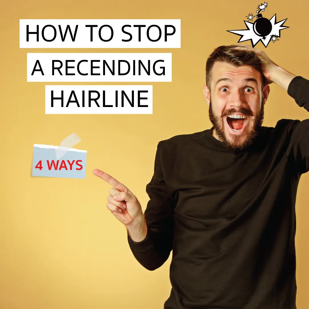 Four Effective Ways to Stop Receding Hairline
