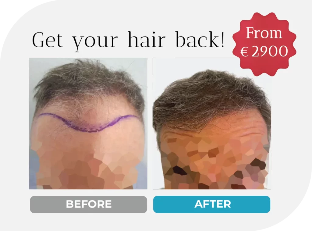 Before after cost