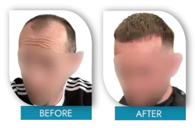 beforeafter7